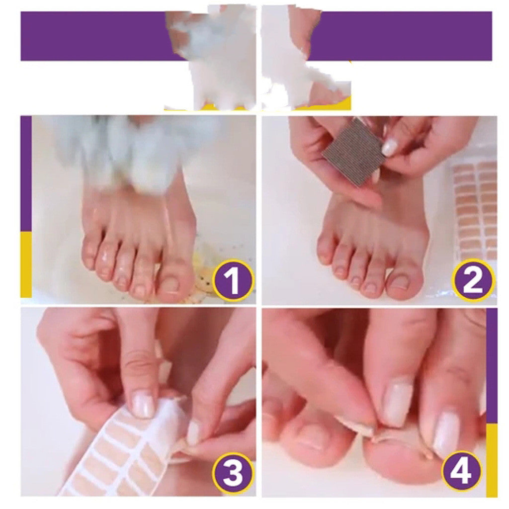 Orthodontic Nail Patch For Orthodontic Nail Correction