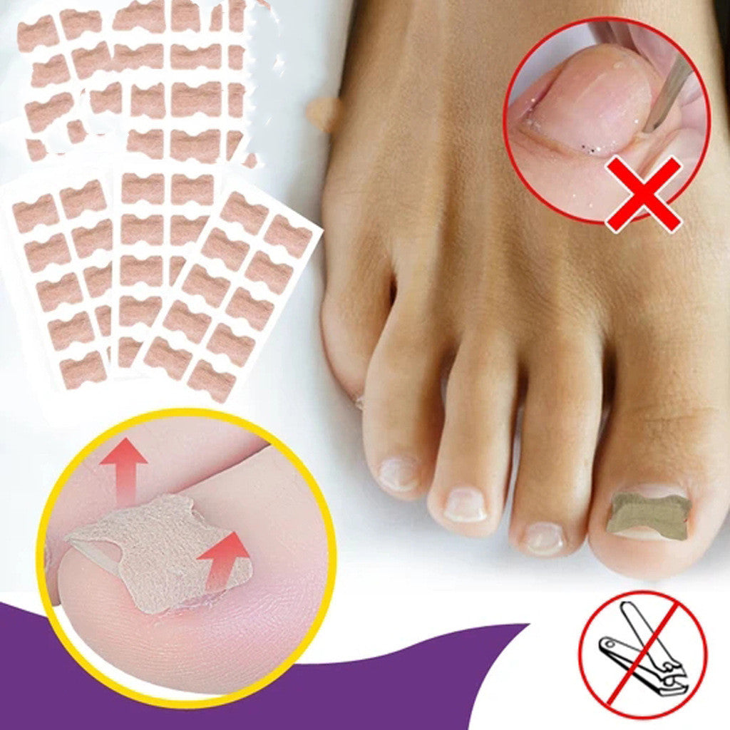 Orthodontic Nail Patch For Orthodontic Nail Correction